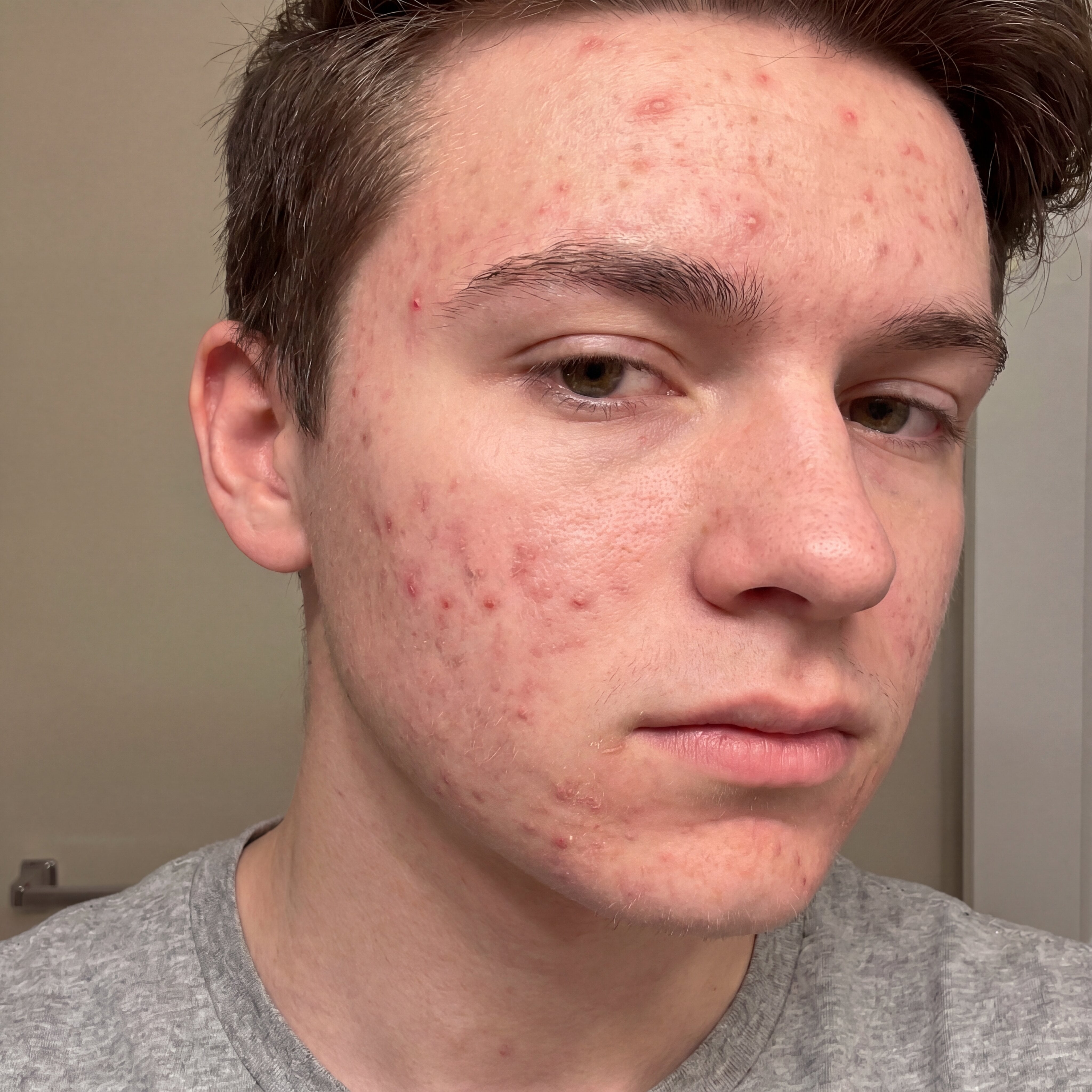 Breakouts_Jpeg.jpg
